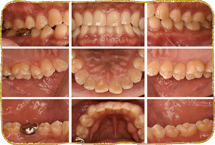 流山市・おおたかの森 みわ歯科・矯正歯科