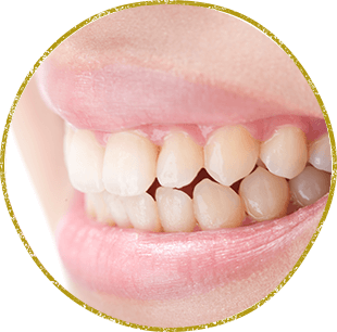 歯ぎしり・食いしばり